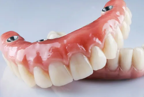 all on 6 dental implants full arch dental implant zirconia