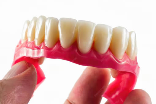 all on 6 dental implants bottom denture